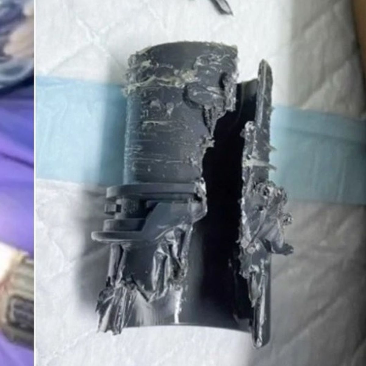 Se agrandó el pene y se le quedó atascado en un tubo